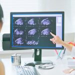 AI detects ovarian cancer better than human experts in new study