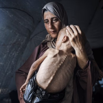 New York Times clarifies misleading image of Gaza child claimed to be starving