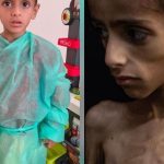 Image of Gazan child with genetic illness being used to falsely smear Israel, COGAT charges