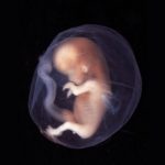Health Ministry revokes IVF licenses over embryo mix-up