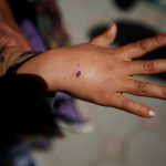 Rabid dog kept in Haifa kindergarten, multiple children attacked