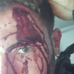 Israeli traveler attacked in Nepal: ‘They heard Hebrew and hit me in the head with an iron bar’